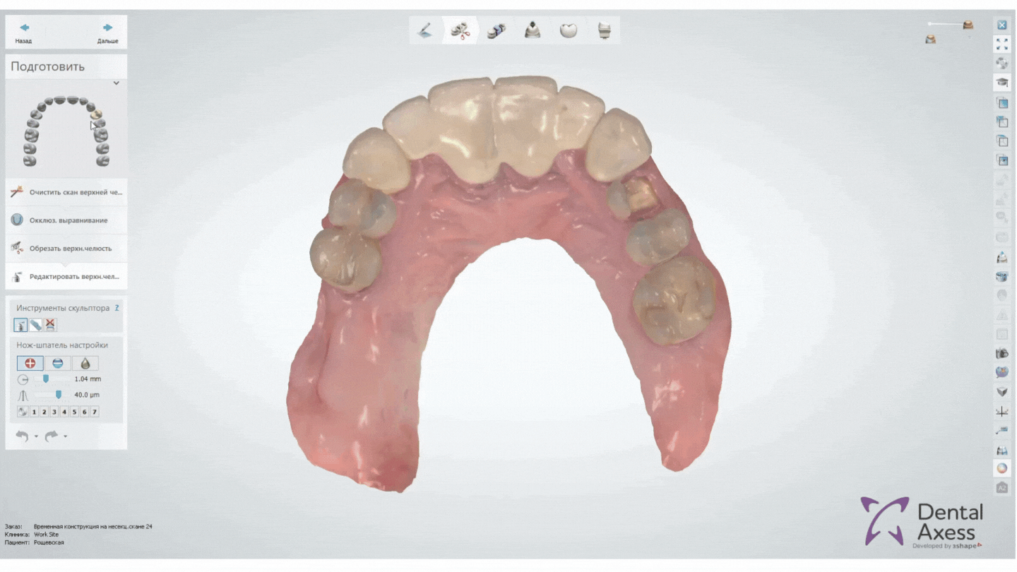 моделирование коронки зуба